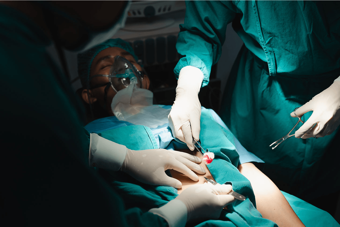 Surgery at Malhotra Nursing Home
